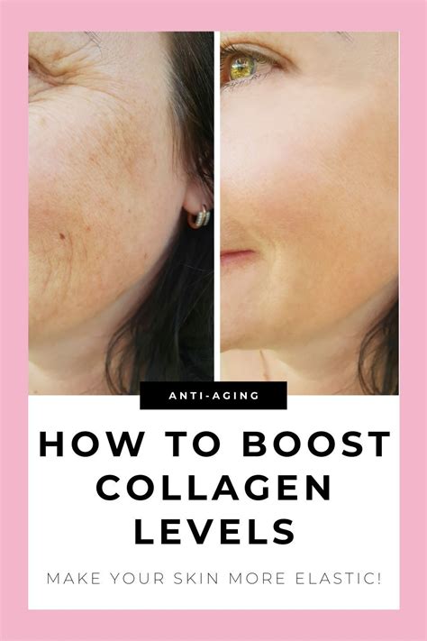 How To Rebuild Collagen In The Face Using These Steps Artofit