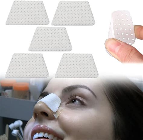 What Is A Nose Splint