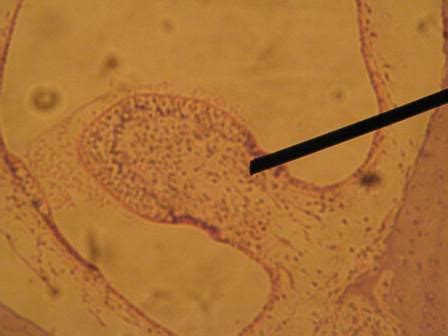 Crista Ampullaris Histology