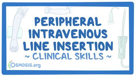 Peripheral intravenous line: Video & Anatomy | Osmosis