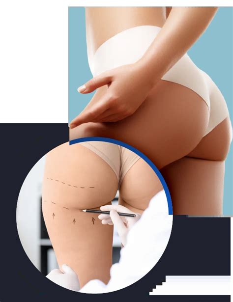 Lipofilling fessier Tunisie prix lifting brésilien des fesses