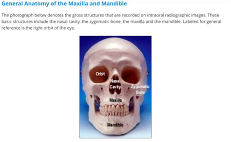 Intraoral Radiographic Anatomy Study Guide Flashcards Quizlet