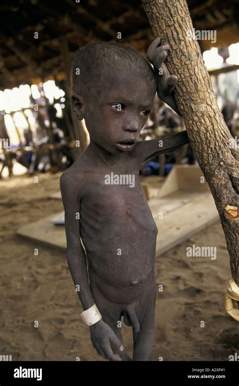 impending famine sudan malnourished child 1998 Stock Photo - Alamy