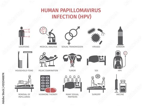 Human Papillomavirus Infection Hpv Vector Infographics Stock Vector