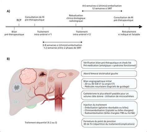 JLE Hépato Gastro Oncologie Digestive Traitements intra artériels