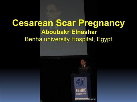 Cesarean Scar Pregnancy Ppt