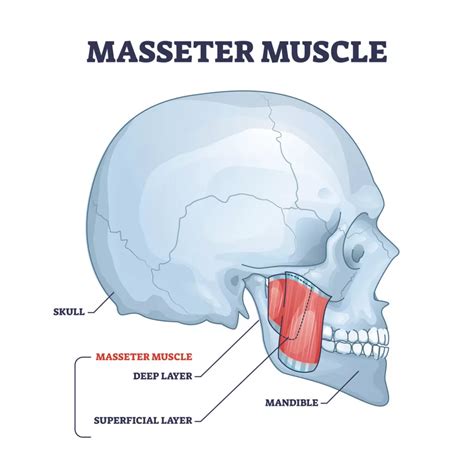 The Role Of Masseter Botox In Tmj Treatment