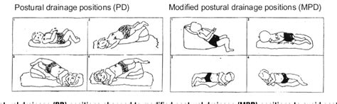 Postural Drainage Positions Pdf