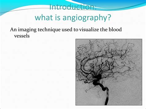 Ppt Angiography Powerpoint Presentation Free Download Id 5177574