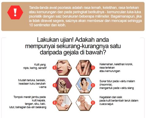 Tahukah Anda?: Penyakit kulit Psoriasis