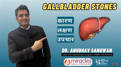 Understanding Gallstones Causes Symptoms And Effective Treatments By