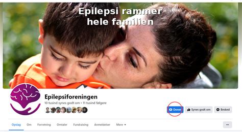 Sådan kan du støtte og samle ind til epilepsisagen på Facebook