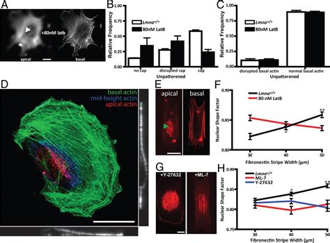 A Perinuclear Actin Cap Regulates Nuclear Shape PNAS