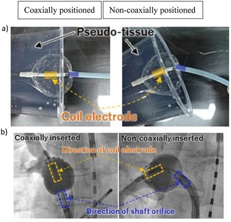 Different Positionings Of The Balloon Catheter Coaxial Position The