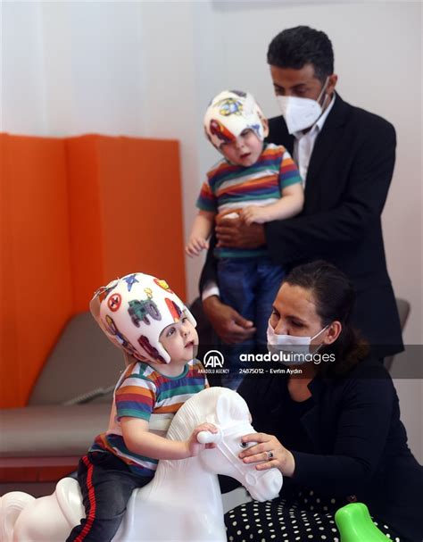 Conjoined Twins Celebrate Their Birthday After Successful Separation Anadolu Images