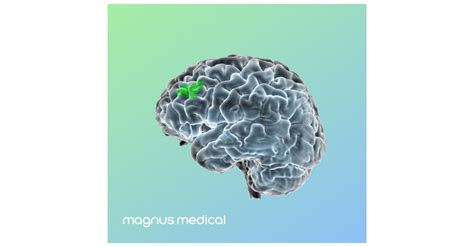 Magnus Medical Announces American Medical Association Issues New CPT