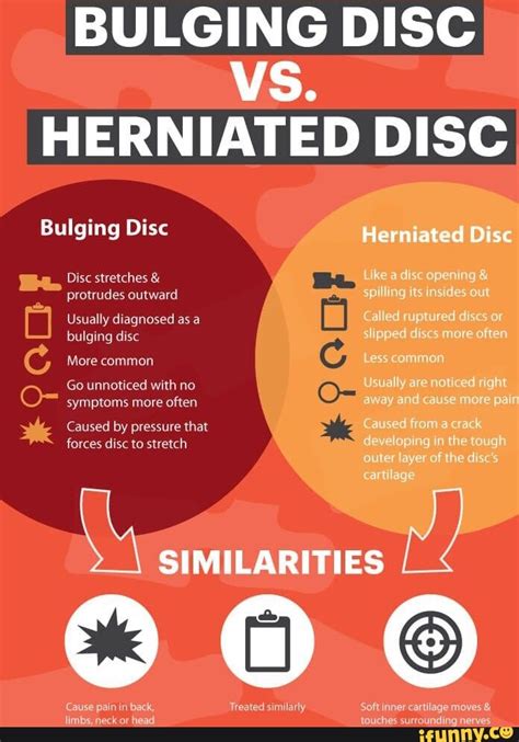 BULGING DISC VS. HERNIATED DISC Bulging Disc Disc stretches & protrudes ...