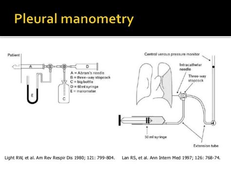 Medical Pleurodesis