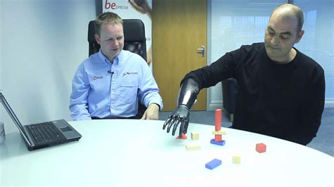 Bionic Arm Comes With A Twist