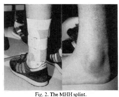 Figure 1 From Primary Orthotic Treatment Of Ruptured Ankle Ligaments A