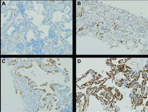 Representative Examples Of Immunohistochemical Staining For Romo1 In