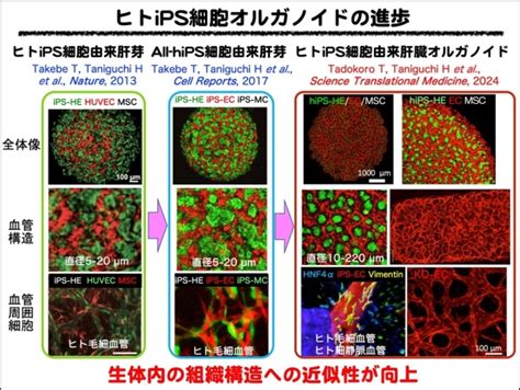 ヒトips細胞由来の肝臓オルガノイド移植による 革新的な肝線維化治療法の開発 ―― 肝硬変に対する免疫制御を介した新規治療法――｜東京大学医科学研究所