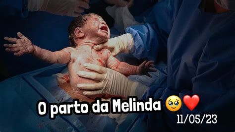 Meu Parto Ces Rea O Nascimento Da Melinda Youtube