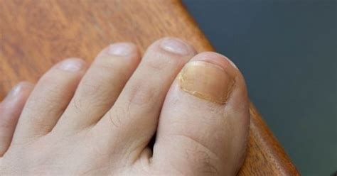 Keeping Toenails Dry Health Pinterest How To Get Thick Toenails And To Get