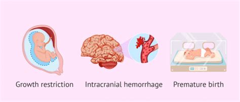 Complications Of Pregnancy From Heart Disease