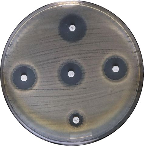 Mueller Hinton Agar 500 G Pvl Produtos Para Laboratório Lda