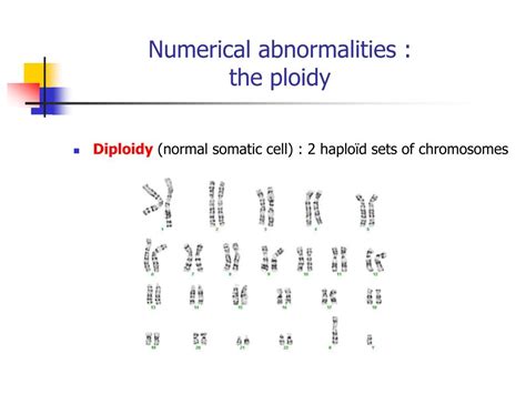 Ppt Chromosome Abnormalities Powerpoint Presentation Free Download