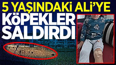 Sokak köpekleri küçük Ali ye saldırdı Haberlisin