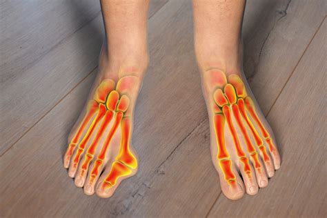 Bunion Foot Inserts Online Bellvalefarms