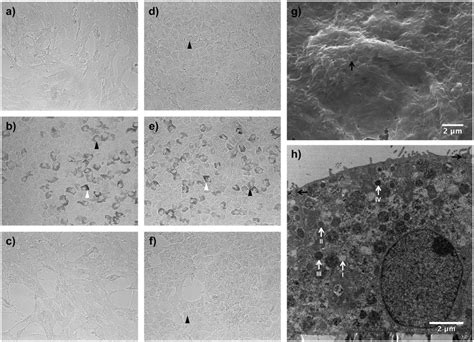 Micro And Ultrastructure Of Human Retinal Pigment Epithelial Cells