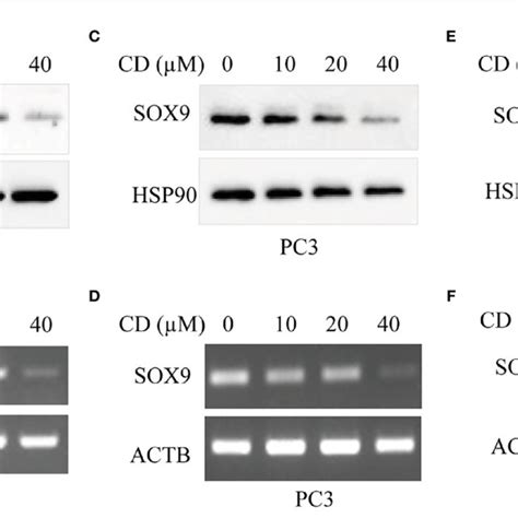 Cd Inhibits The Expression Of Sox In Different Tumor Cells A