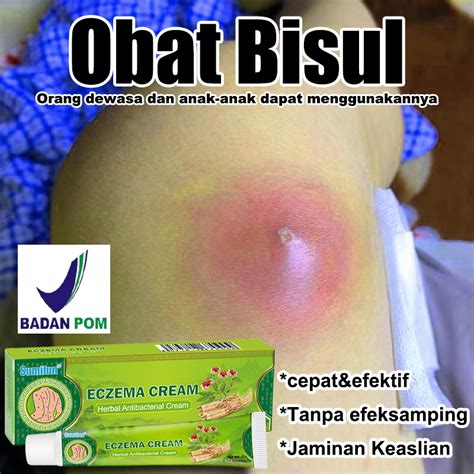 Jual Salep Bisul Obat Bisul Obat Bisul Anak 20g Obat Bisul Di Pantat