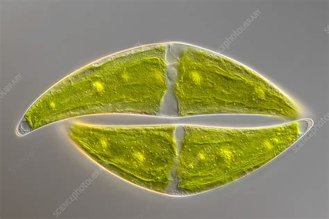 Closterium Moniliferum Algae Light Micrograph Stock Image C057