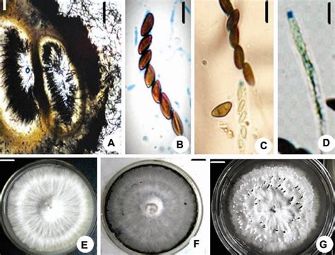 Microscopic Morphological And Culture Features Of X Vasconica A