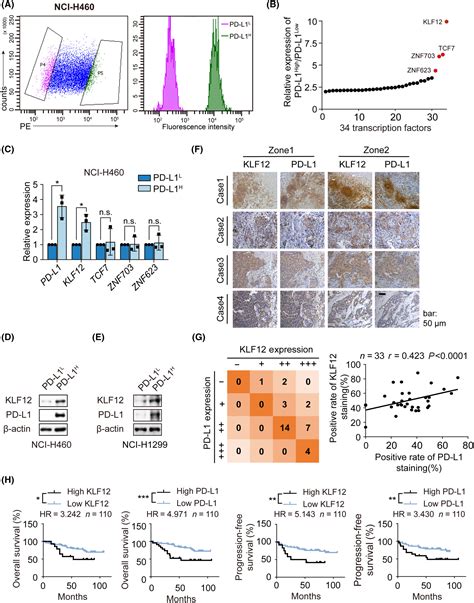 Klf Transcriptionally Regulates Pdl Expression In Nonsmall Cell