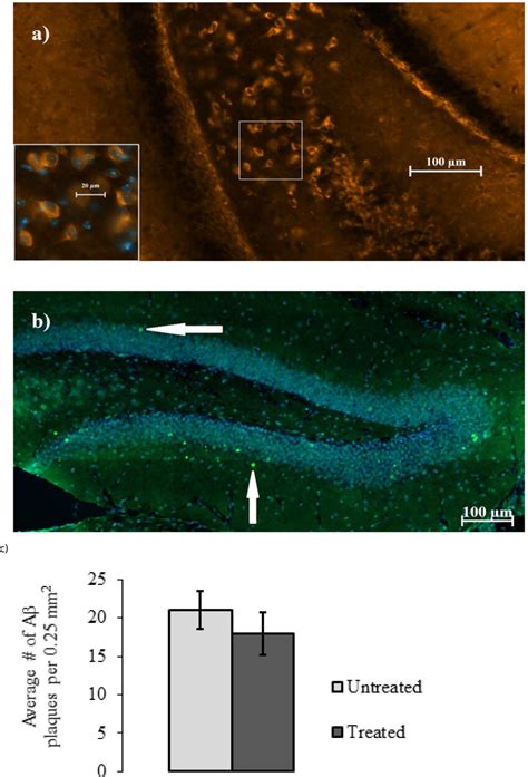 Immunofluorescence And Quantification Of Senile Amyloid Plaques In The