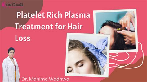 Platelet Rich Plasma For Hair Loss Treatment