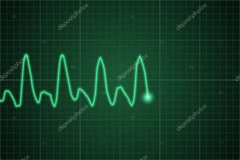 Pulso Del Monitor Cardíaco Línea De Latidos Del Corazón Gráfico De Frecuencia Cardíaca