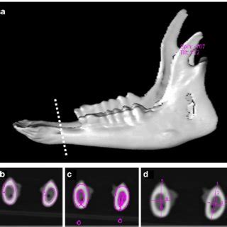 Three Dimensional 3D Computed Tomography Reconstruction Of Mandible