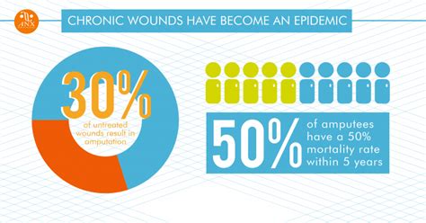 Advanced Wound Care Anx Home Healthcare And Hospice Care