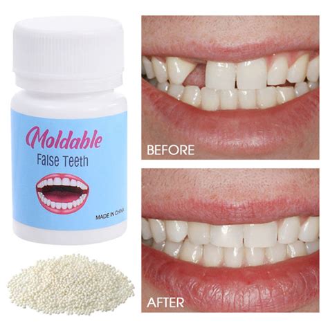 Resin Tooth Repair Glue Shapeable Teeth Gaps Filling Solid Temporary Teeth Repair Falseteeth