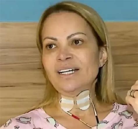 Solange Almeida Revela Dificuldade Para Respirar Ap S Les Es Por Uso De