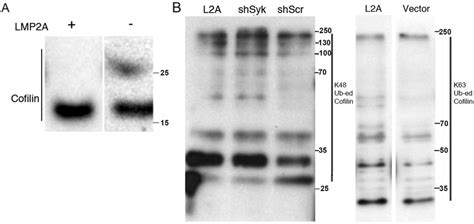 LMP2A Expression Interferes With Ubiquitin Modification Of Cofilin And