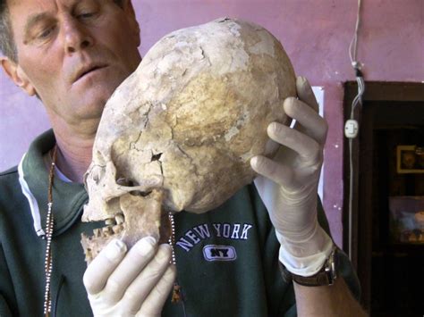 New Paracas Elongated Skull DNA Testing To Be Performed Go Fund Me