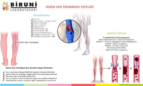 DERİN VEN TROMBOZU Biruni Genetik