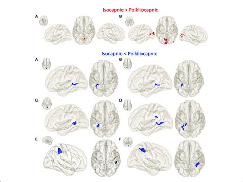 Seed To Voxel Functional Connectivity Results The First Panel Shows Download Scientific